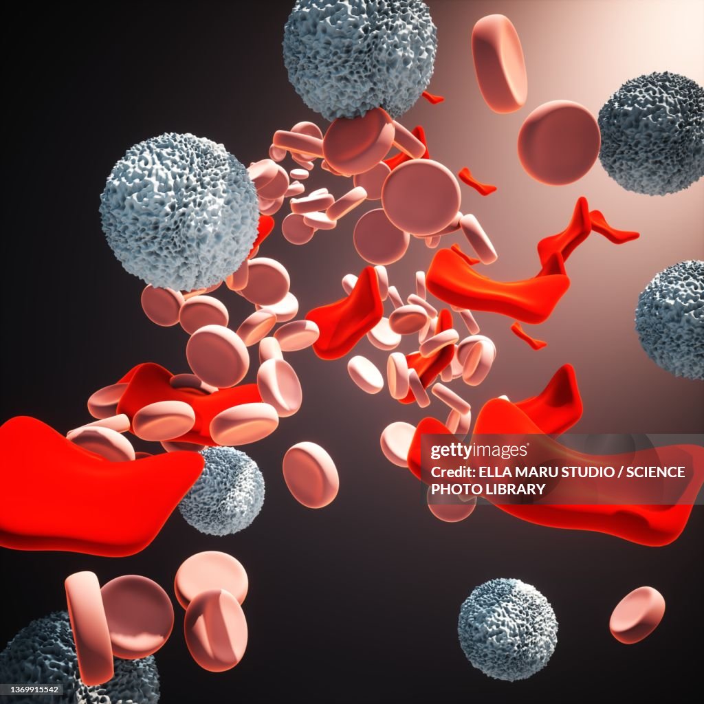Thalassemia, illustration