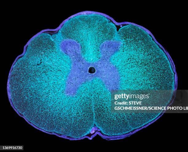 spinal cord, lm - micrografía científica fotografías e imágenes de stock