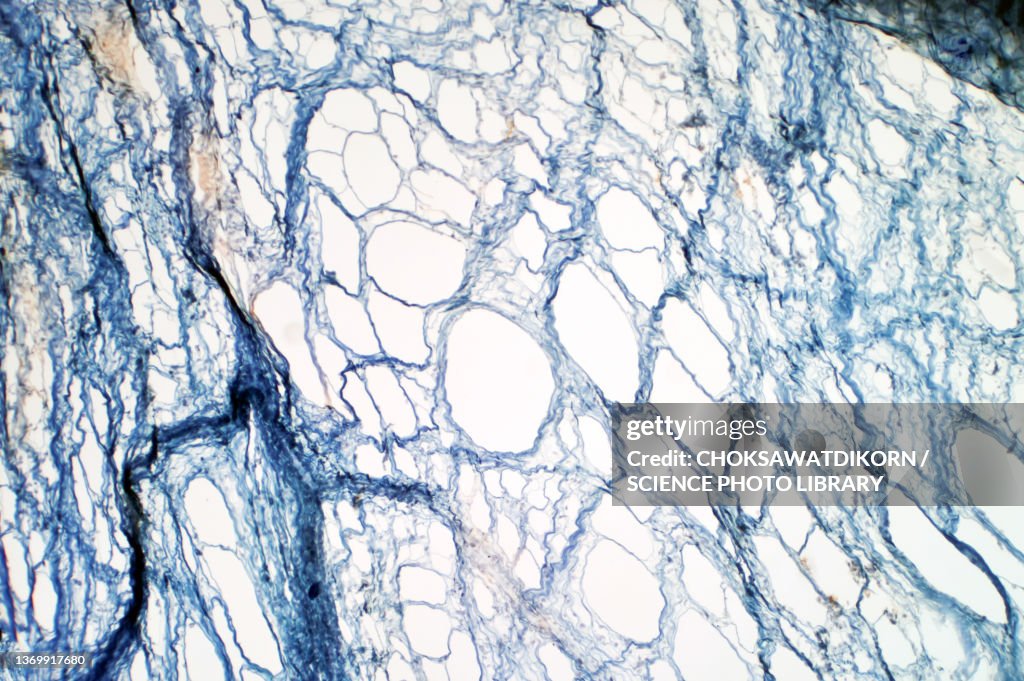 Areolar connective tissue, light micrograph