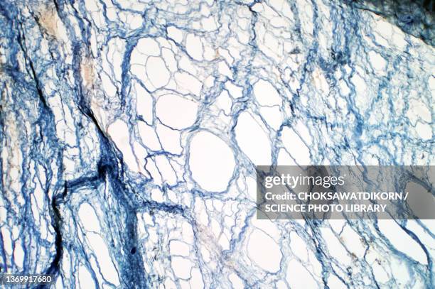 areolar connective tissue, light micrograph - tecido conjuntivo reticular imagens e fotografias de stock