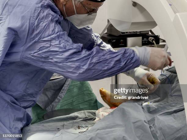 orthopedic surgeon performs a difficult ankle surgery, close up view - ankle surgery stock pictures, royalty-free photos & images