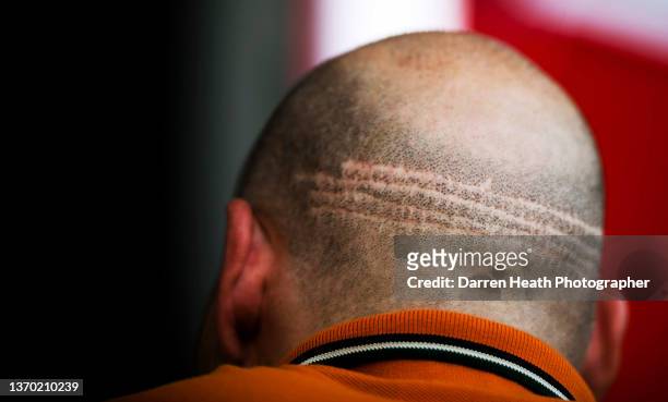 French-Canadian ex-Formula One racing driver Jacques Villeneuve with a short shaved hair cut revealing the scars from stitches from hair transplant...