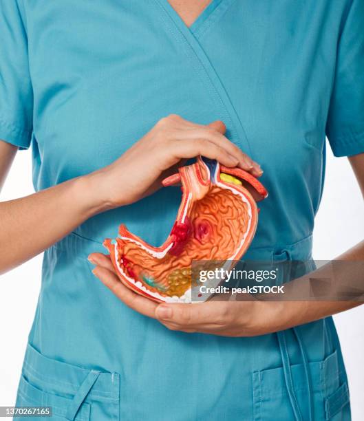 Diagnosis and treatment of stomach disease. Doctor holding anatomical model of stomach with pathologies. Stomach health concept