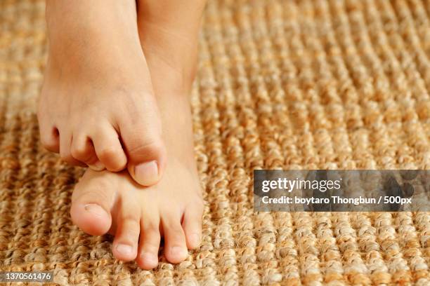 fungal foot itching caused by biting feet - foot fungus stock pictures, royalty-free photos & images