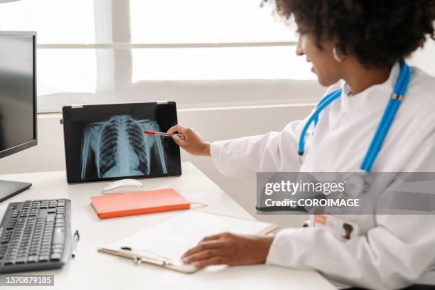 female doctor looking at a chest x-ray. - brustkorb stock-fotos und bilder