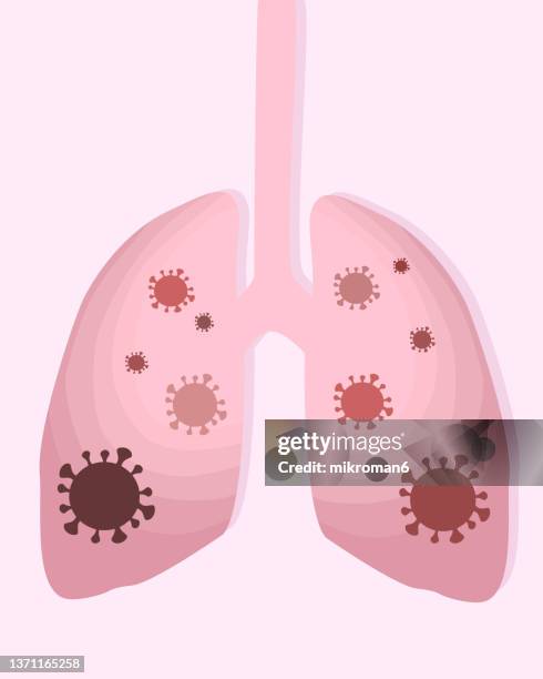 vector of infected lungs with virus or bacteria. there is sickness inside the lungs visible in the image - protective face mask vector stock pictures, royalty-free photos & images