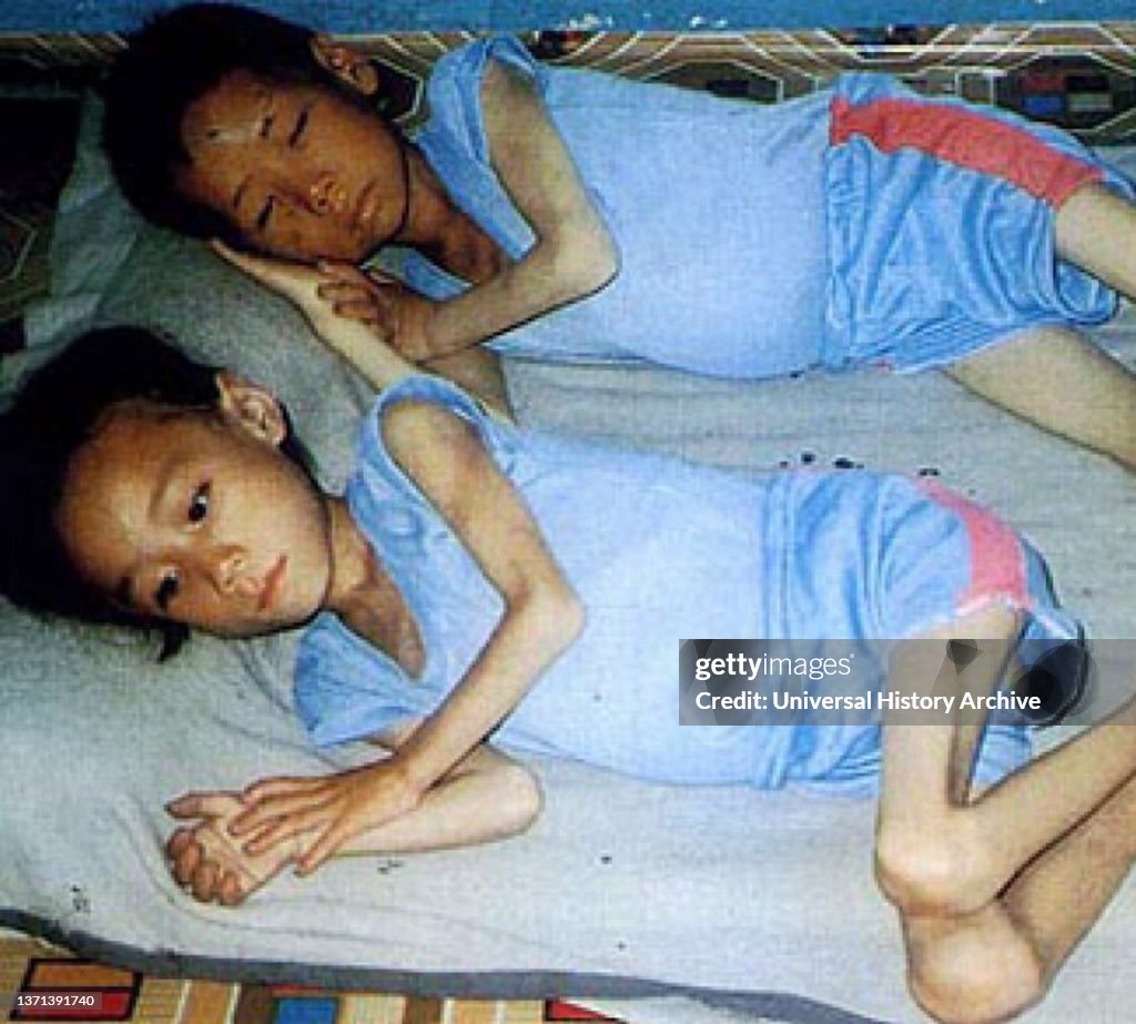 Emaciated brother and sister lie prone at Unsun kindergarten in South Pyongyang.