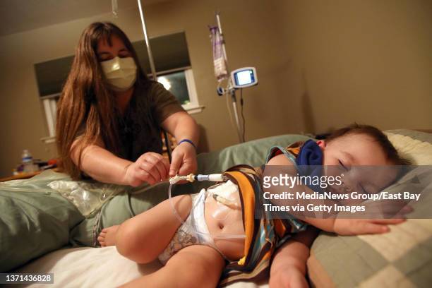 Kristi Ouimet performs peritoneal dialysis on her son Matthew Ouimet, 21 months, at her home in Antioch, Calif., on Friday, Nov. 2, 2012. This type...