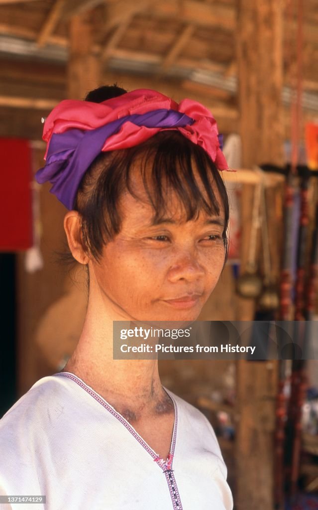A Padaung (Long Neck Karen) woman after removing her neck rings for cleaning, village near Mae Hong Son.