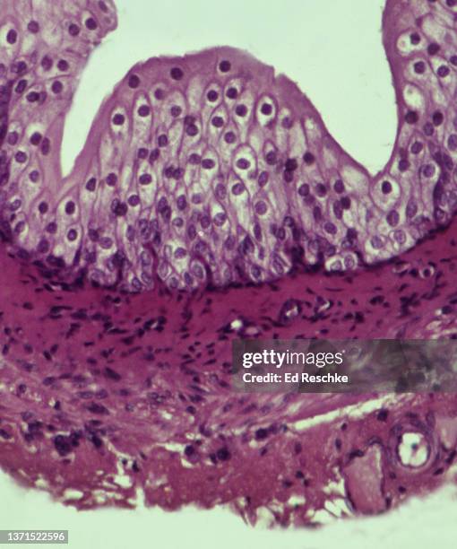 microscopic anatomy (histology) of the ureter and transitional epithelium lining the ureter, 100x - transitional epithelium stock pictures, royalty-free photos & images