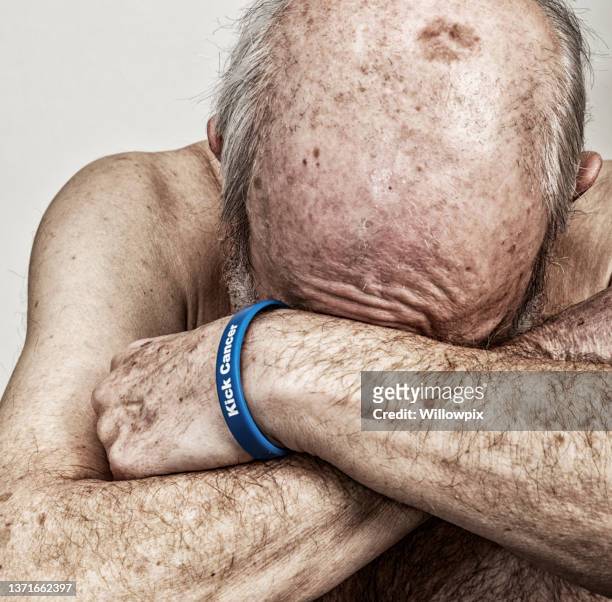 erschöpfter senior man krebs chemotherapie patient - keratosis stock-fotos und bilder