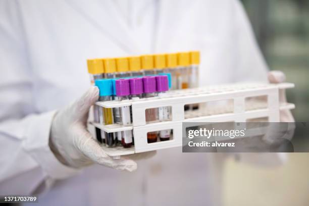 Full Lab Sample 1,759 Medical Lab Sample Stock Photos, High-Res Pictures, and Images ...