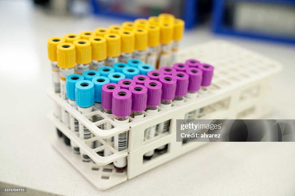 Sample test tubes with multicolor lids a rack in laboratory