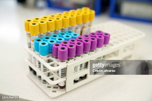 sample test tubes with multicolor lids a rack in laboratory - tube imagens e fotografias de stock