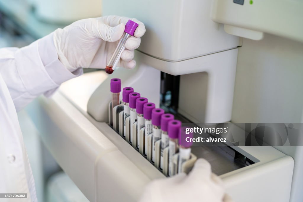 Gros plan d’un gant de médecin travaillant dans un laboratoire d’essais