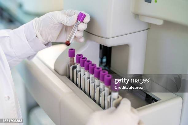 gros plan d’un gant de médecin travaillant dans un laboratoire d’essais - tube de prélèvement sanguin photos et images de collection
