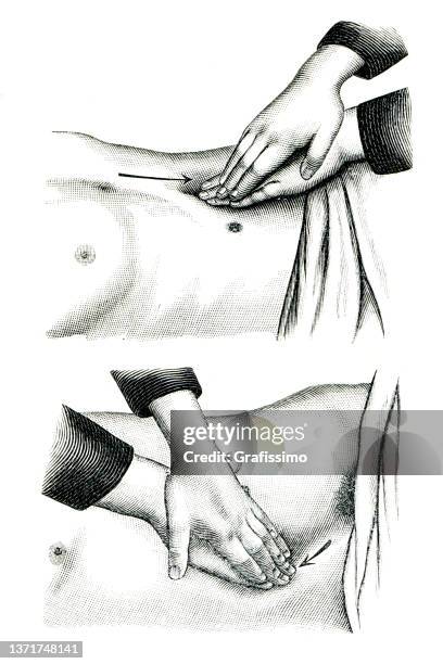 illustrations, cliparts, dessins animés et icônes de exercice de gymnastique machine pour la rééducation 1896 - partie du corps humain