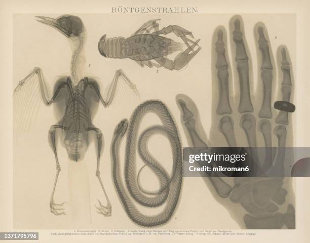 old engraved illustration of early x-ray photography - röntgen stock pictures, royalty-free photos & images