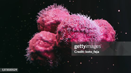 Cancer malignant cells Cancer malignant cells