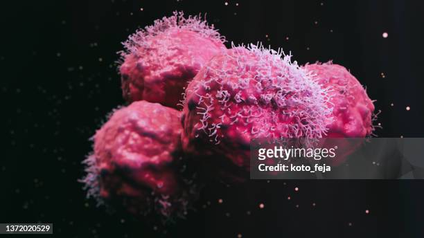 cancer malignant cells - vergroting stockfoto's en -beelden