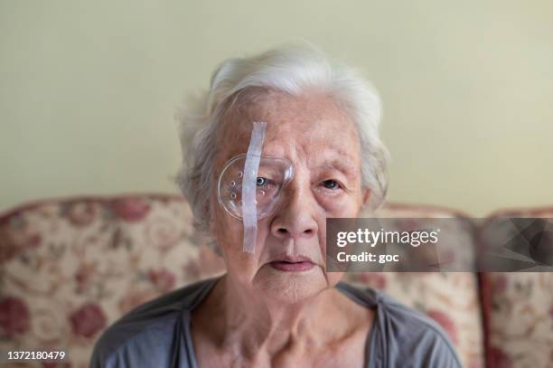 senior asian woman covering her eye with protective shield and sitting on sofa in living room - cataract surgery stock pictures, royalty-free photos & images