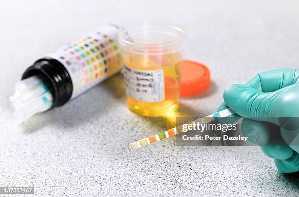 urine testing - urine stockfoto's en -beelden