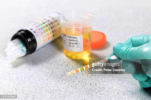 urine testing - urine sample stock pictures, royalty-free photos & images