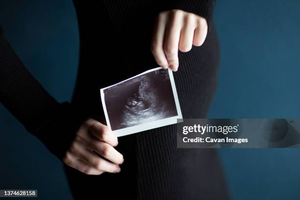 woman's hands holding an ultrasound of her baby on dark background - ultrasound scan stock-fotos und bilder