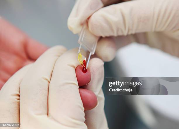 blood group determination.. - blood type stock pictures, royalty-free photos & images