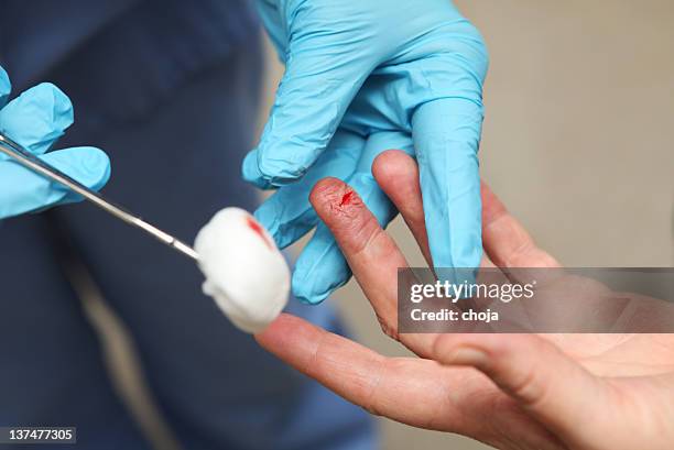 nurse is changing bandage to a wounded patient's finger - nurse wound stock pictures, royalty-free photos & images