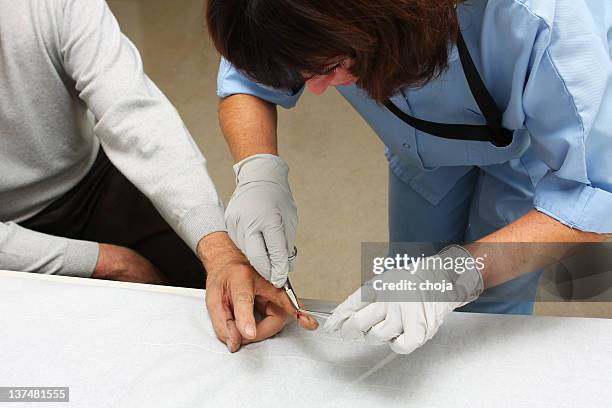 nurse is taking care of the wounded patient...removing stitches - suture stock pictures, royalty-free photos & images