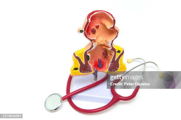 human anatomy teaching model of rectum - anal stock pictures, royalty-free photos & images