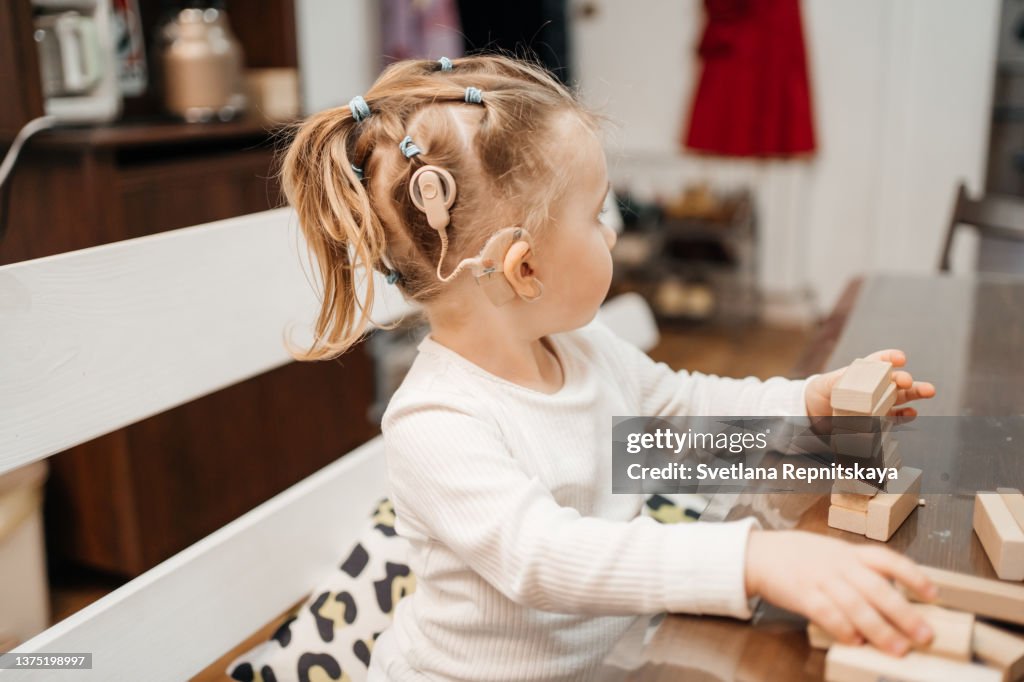 Baby with cochlear implants having fun.