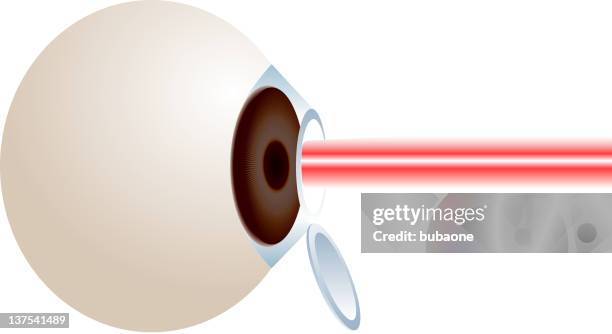 ilustrações, clipart, desenhos animados e ícones de lasik cirurgia nos olhos - nervo ótico