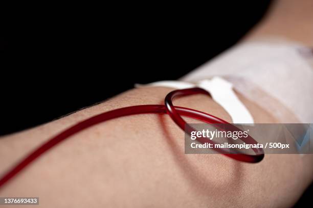 voluntary blood donation on the go and hemodialysis - blood donation imagens e fotografias de stock