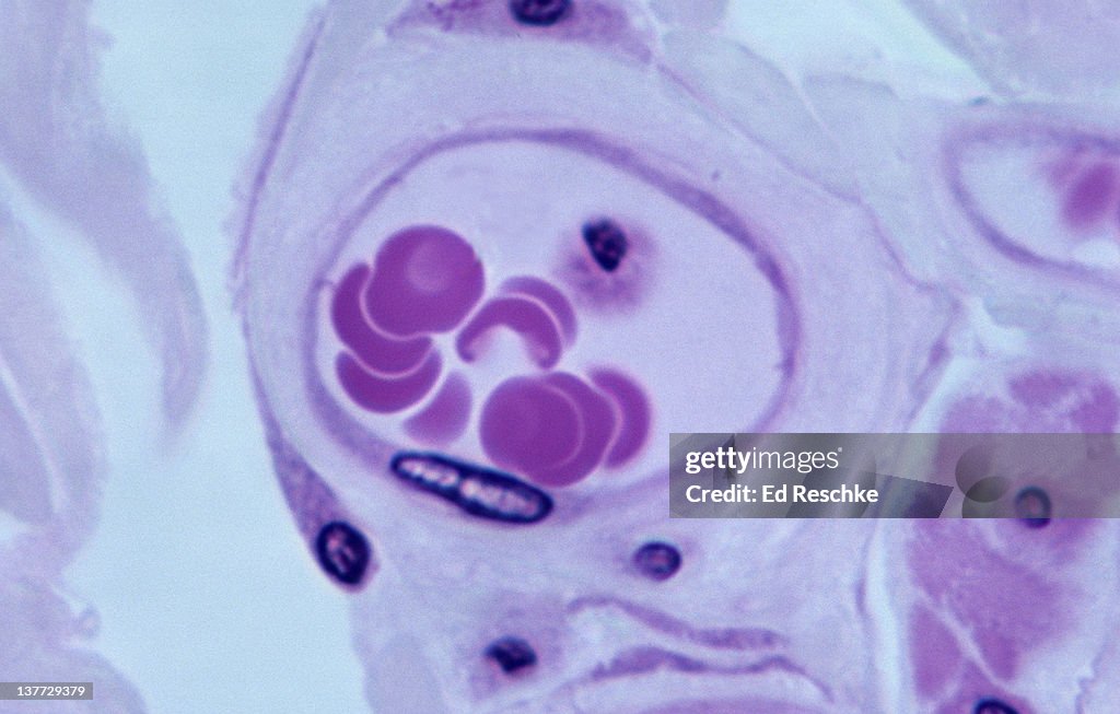Endothelium lining a blood vessel (Venule), 500x