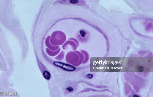 endothelium lining a blood vessel (venule), 500x - simple squamous epithelium stock pictures, royalty-free photos & images