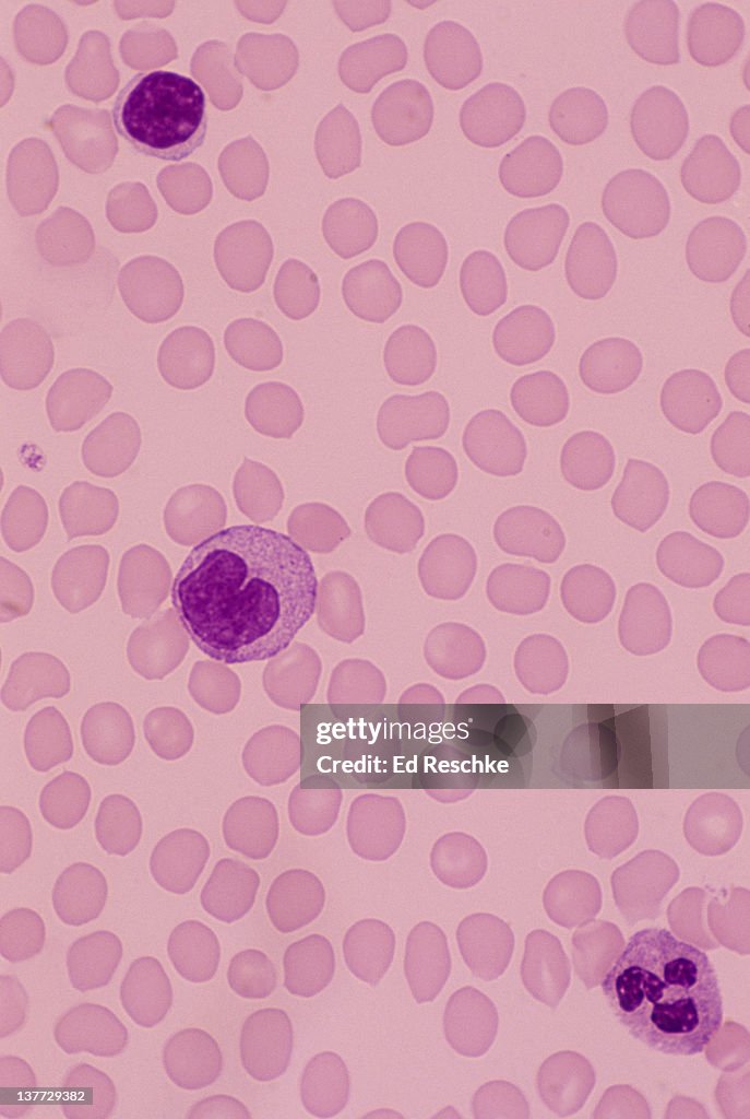 White Blood Cells-Lymphocyte, Monocyte, Neutrophil