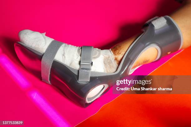 foots splint - convertible isolated stock pictures, royalty-free photos & images