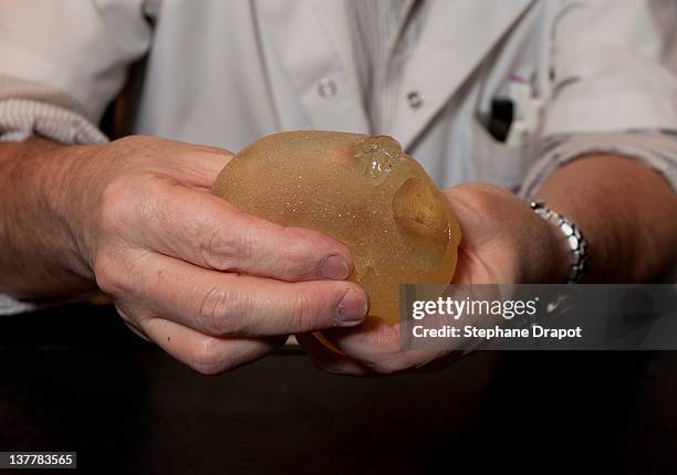 French Doctor, Denis Boucq , owner of the Clinic Mozart at Nice is showing scratched PIP implants on January 23, 2012 in Nice, France. French Doctor,...