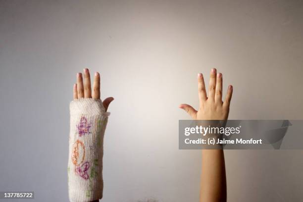 broken arm - hand injury - fotografias e filmes do acervo