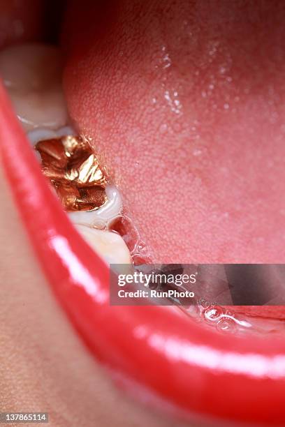 young woman with gold tooth - tooth cap stock pictures, royalty-free photos & images