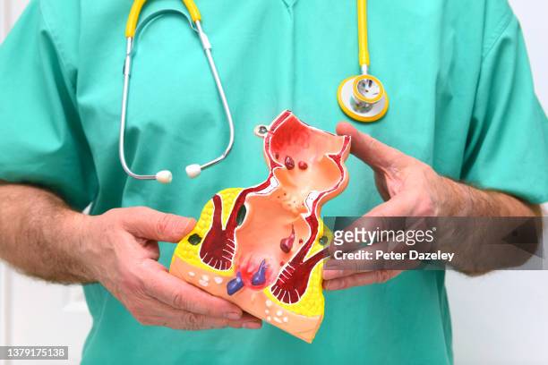 surgeon with rectum teaching model - anal stock pictures, royalty-free photos & images
