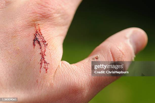 scar auf seite - wunde stock-fotos und bilder