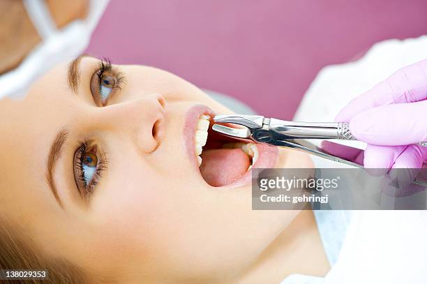 presso il dentista visita di intervento - extraction forceps foto e immagini stock