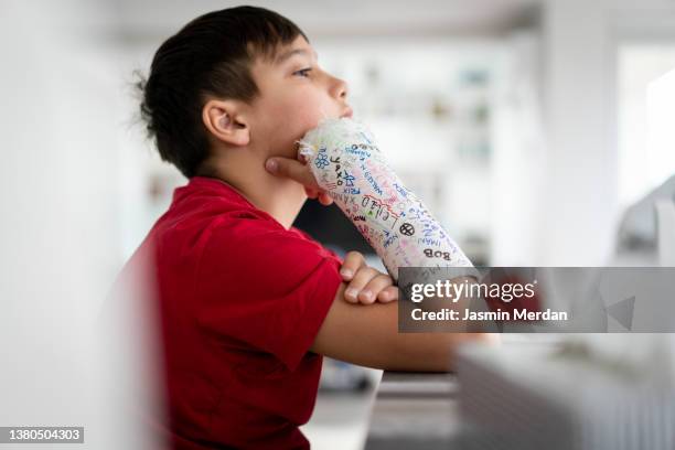 kid with broken arm and friends' signatures on bandage - broken arm foto e immagini stock