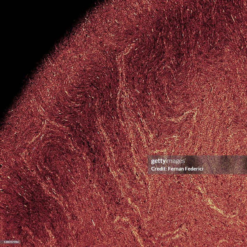 Bacterial biofilm colony