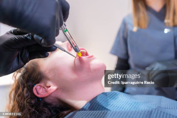 Wisdom Injection Wisdom Tooth Extraction Photos and Premium High Res Pictures - Getty Images