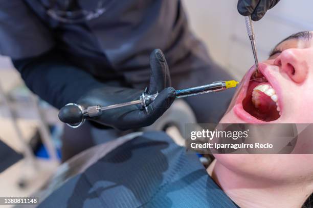 Wisdom Injection 72 Wisdom Tooth Surgery Stock Photos, High-Res Pictures, and Images ...