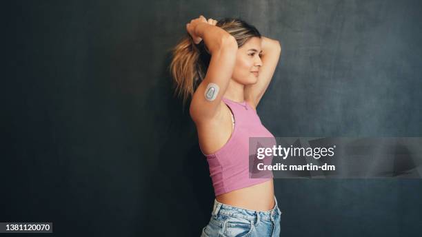 porträt einer jungen frau mit diabetes typ1 - fühler stock-fotos und bilder